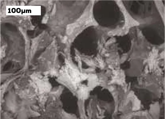 Hueso humano al microscopio